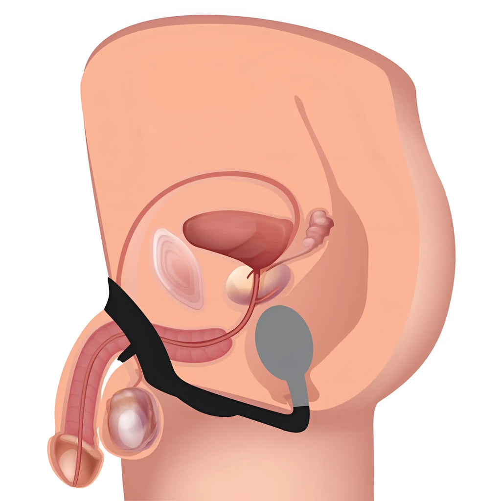 Medical-style diagram showing the black Alpha Pro 10X P-Bomb cock ring and vibrating anal plug in place.