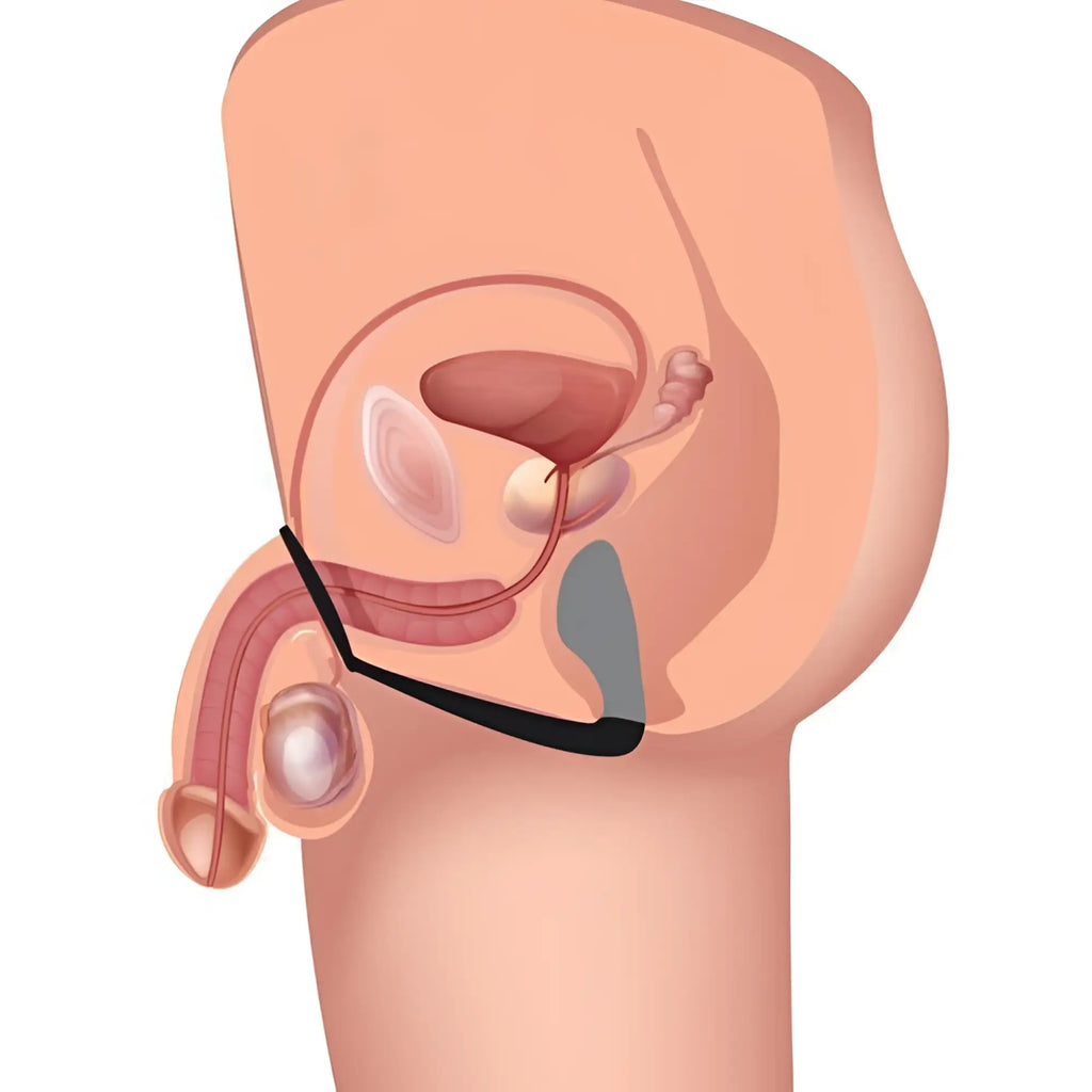 An anatomical diagram showing the Prostatic Play Explorer II, a grey prostate stimulator connected to a black cock ring.