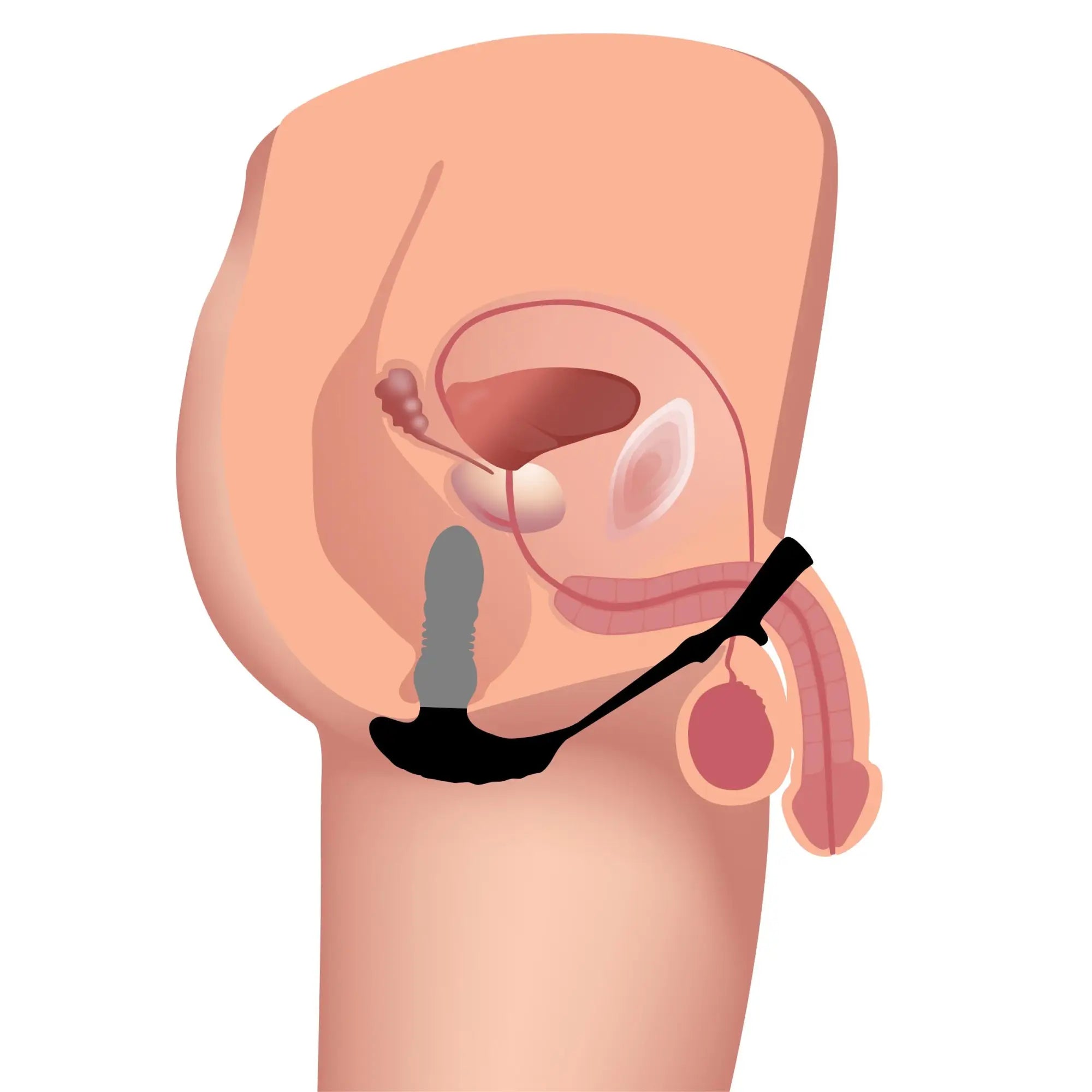 Anatomical diagram showing the Thunderplugs thrusting vibrator with a black cock ring inserted in the body.