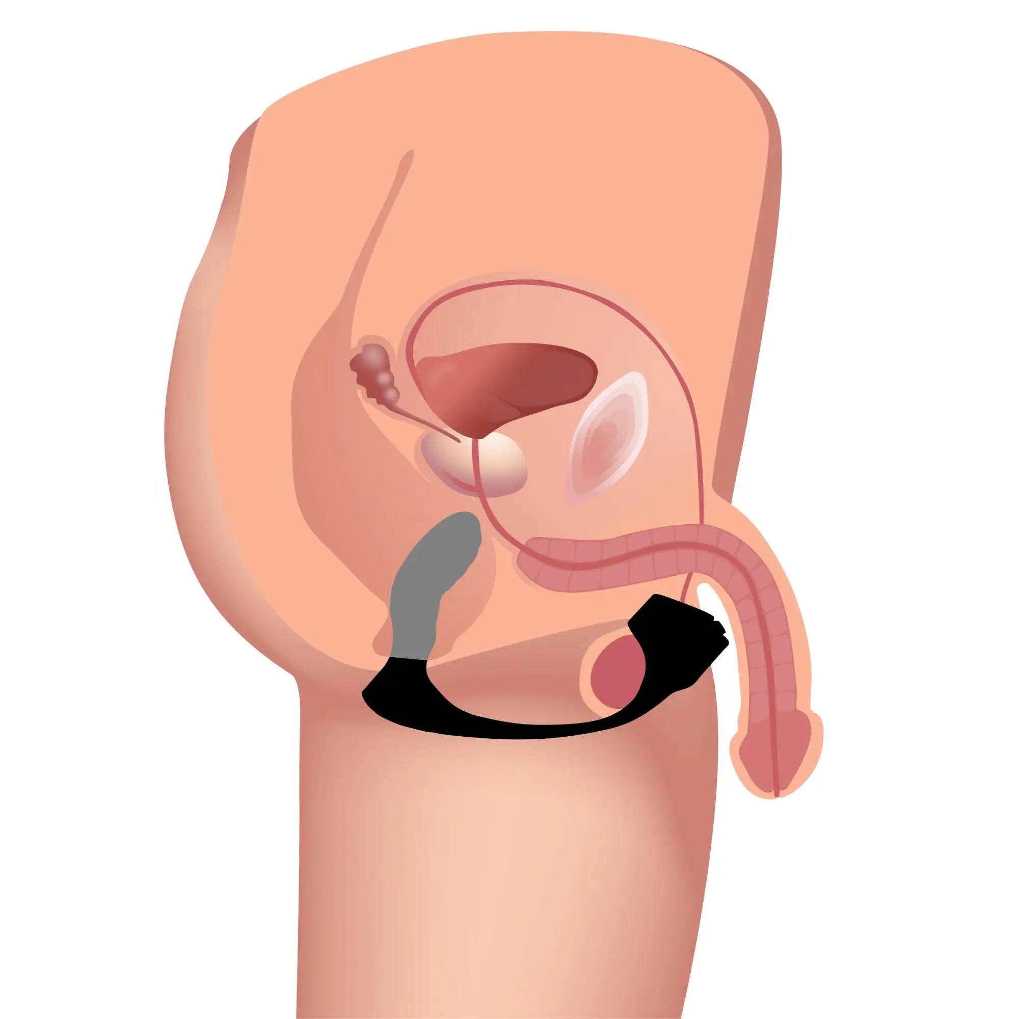 Anatomical illustration showing the black Trinity Men 7X silicone prostate plug and ball stretcher in use.